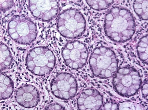 Endocrinologist